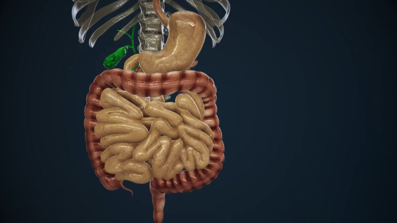 Diarrhea Visual Representation