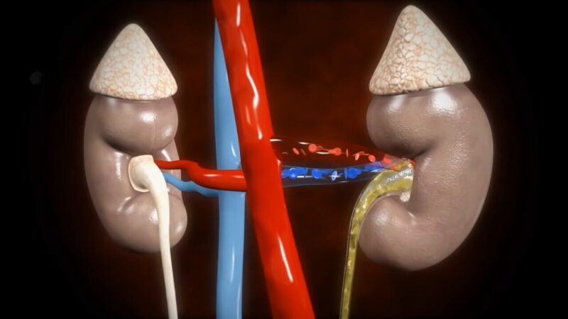 Glomerular Filtration