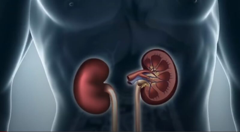 Hypertensive Nephropathy