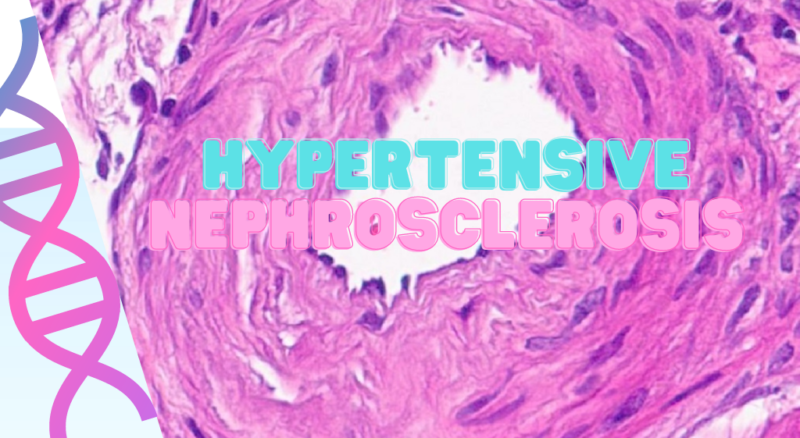 Hypertensive Nephrosclerosis