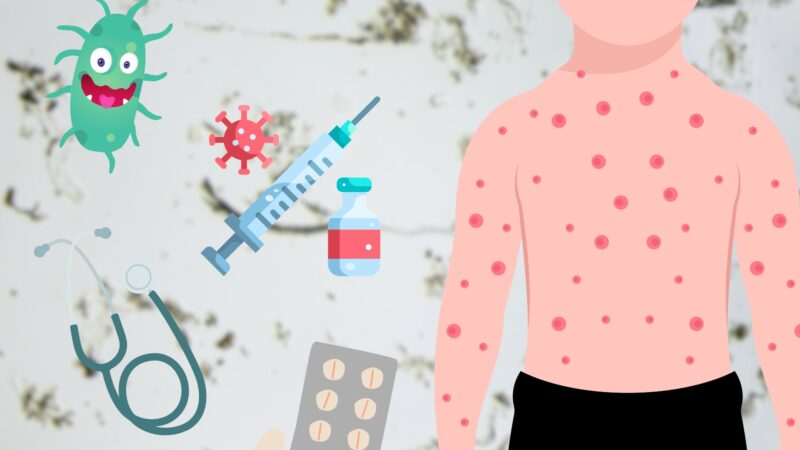 Syphilis, outcome of bacteria T. pallidum