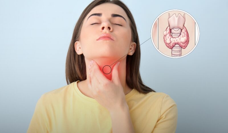 Thyroid Hormone Synthesis