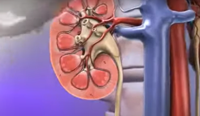 kidney