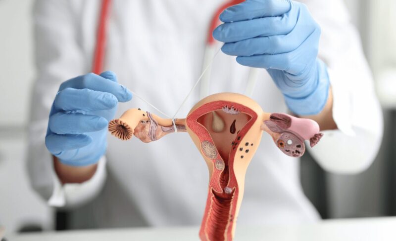 How To Conceive Without Fallopian Tubes