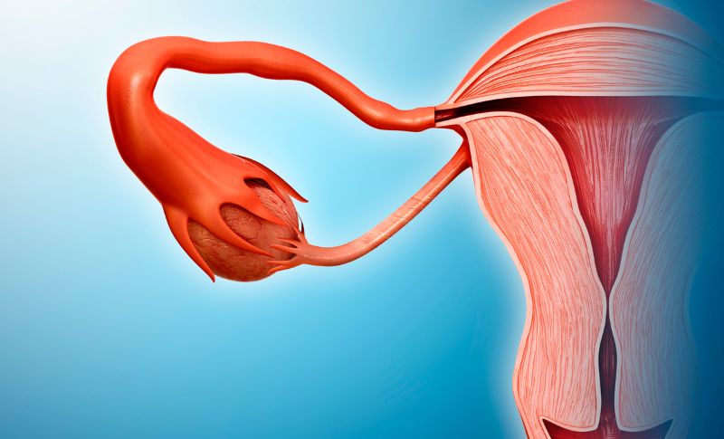 Why Fallopian Tubes Might Be Absent or Damaged