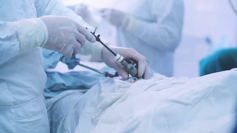 Laparascopic Gallbladder Surgery