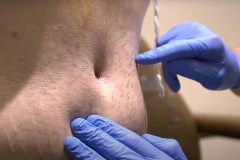 Reduce swelling after surgery