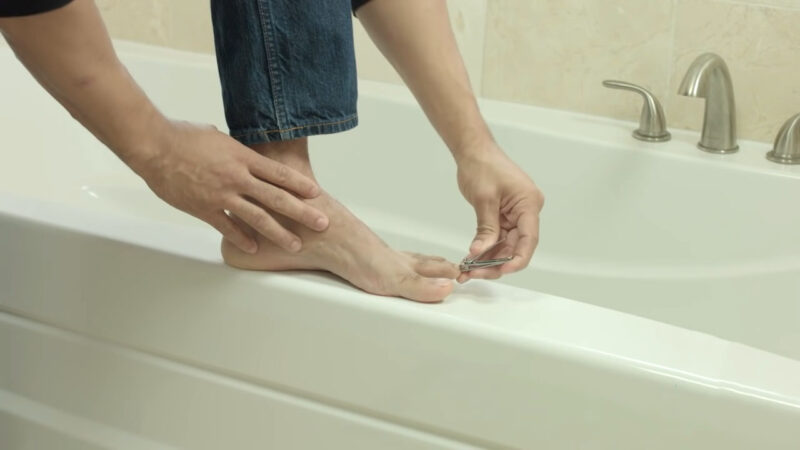 Nail Fungal Infection - Prevention Techniques
